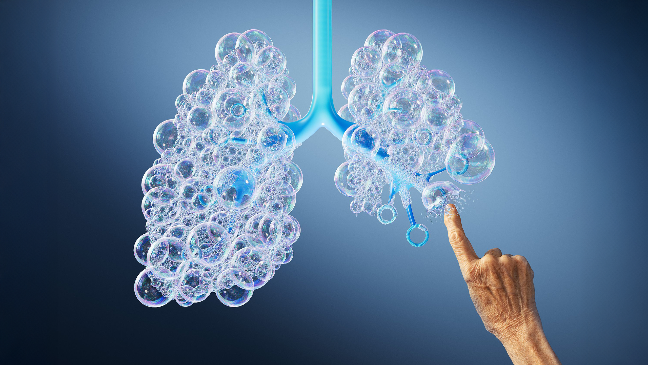 24_7754_COPD_BUBBLE_M_w1_F_3k